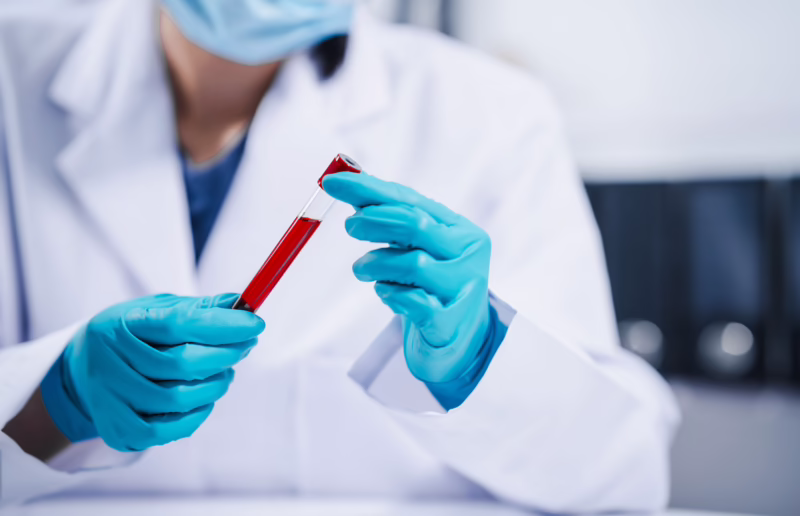 What-Your-Lab-Results-Really-Mean-in-Rheumatology | Amarillo Medical Specialists Rheumatology