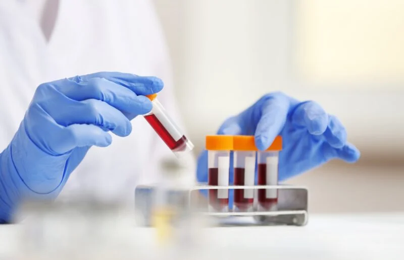Woman working with blood samples in laboratory, closeup | Amarillo Medical Specialists Rheumatology